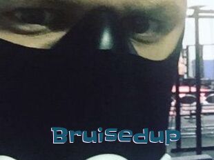 Bruisedup