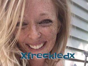 Xfreckledx